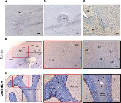 Expression and Function of IL-33/ST2 Axis in the Central Nervous System Under Normal and Diseased Conditions